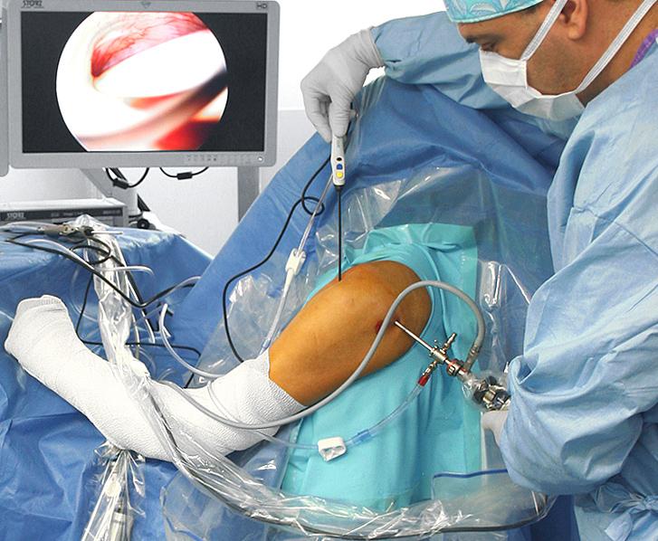 Neuro Surgery